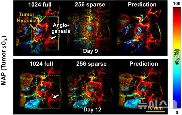 본문 이미지 썸네일