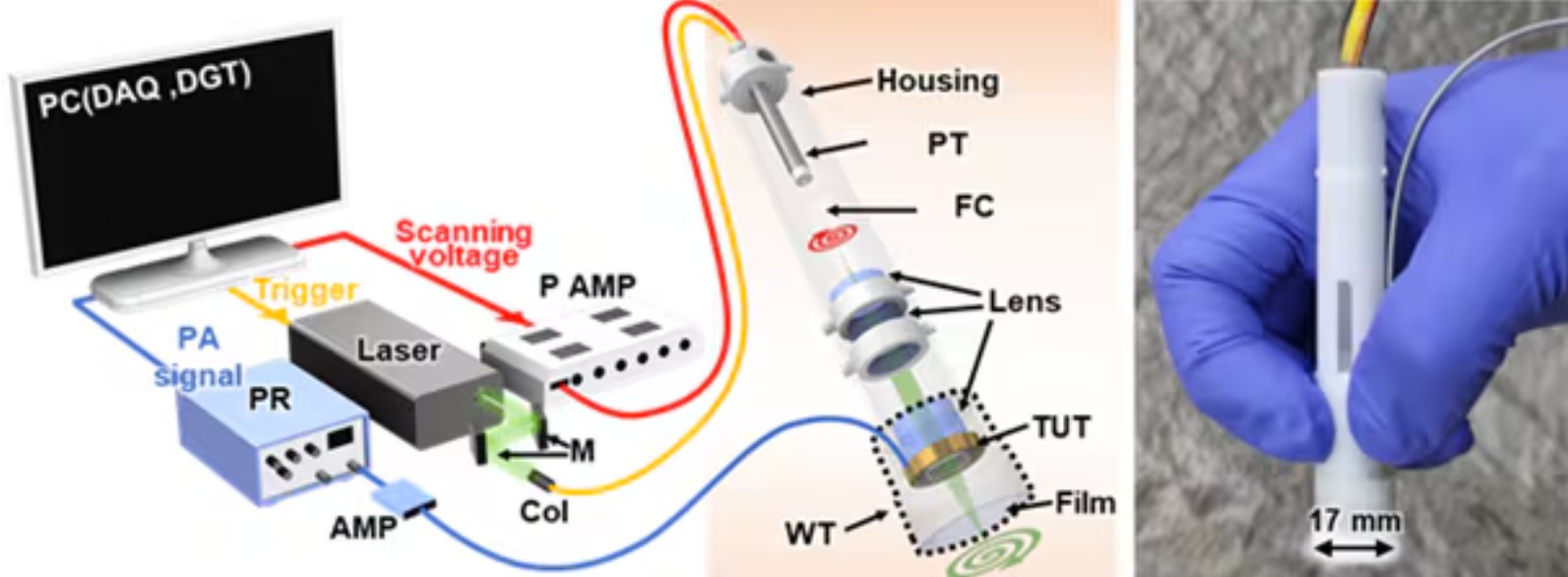 본문 이미지 썸네일